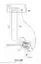 Fig. 04 - MULTI-ELECTRODE APPARATUS FOR TISSUE WELDING AND ABLATION