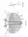 Fig. 15 - MULTI-ELECTRODE APPARATUS FOR TISSUE WELDING AND ABLATION
