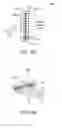 Fig. 16 - MULTI-ELECTRODE APPARATUS FOR TISSUE WELDING AND ABLATION