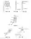 Fig. 09 - ELECTRODE APPARATUS HAVING AT LEAST ONE ADJUSTMENT ZONE