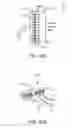 Fig. 16 - ELECTRODE APPARATUS HAVING AT LEAST ONE ADJUSTMENT ZONE
