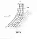 Fig. 08 - Conforming electrode