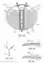 Fig. 06 - MULTI-ELECTRODE APPARATUS FOR TISSUE WELDING AND ABLATION