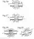 Fig. 07 - Dynamic stabilization connecting member with slitted segment and surrounding external elastomer