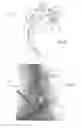 Fig. 06 - KIT AND METHODS FOR MEDICAL PROCEDURES WITHIN A SACRUM