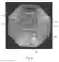Fig. 07 - KIT AND METHODS FOR MEDICAL PROCEDURES WITHIN A SACRUM