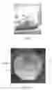Fig. 08 - KIT AND METHODS FOR MEDICAL PROCEDURES WITHIN A SACRUM