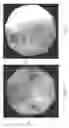 Fig. 22 - KIT AND METHODS FOR MEDICAL PROCEDURES WITHIN A SACRUM