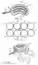 Fig. 06 - Systems and methods treating a vertebral body