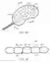 Fig. 07 - Systems and methods treating a vertebral body