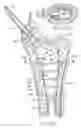 Fig. 08 - Systems and methods treating a vertebral body