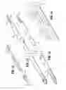 Fig. 09 - Apparatus for applying surgical clips