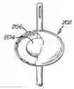 Fig. 01 - Anastomosis Balloon Configurations and device