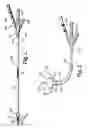 Fig. 02 - Anastomosis Balloon Configurations and device