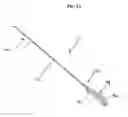 Fig. 02 - PYLORIC PLUG