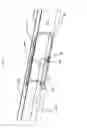 Fig. 07 - PYLORIC PLUG