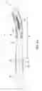 Fig. 07 - APPARATUS FOR CROSSING OCCLUSIONS OR STENOSES