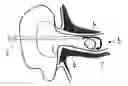 Fig. 01 - Medical instrument for removing objects from tight passages