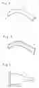 Fig. 03 - Medical instrument for removing objects from tight passages
