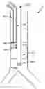 Fig. 01 - Enhanced cuff sealing for endotracheal tubes