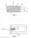 Fig. 02 - Annulotomy closure device and related methods