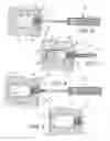 Fig. 04 - Surgical implant