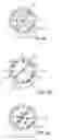 Fig. 07 - METHOD FOR SEALING A PFO USING AN ENERGY DELIVERY DEVICE