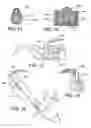 Fig. 07 - Spinal stabilization implant and method of application
