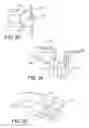 Fig. 09 - Spinal stabilization implant and method of application