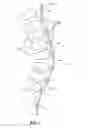 Fig. 02 - Methods and devices for treating a multi-level spinal deformity