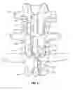 Fig. 09 - Methods and devices for treating a multi-level spinal deformity
