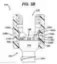 Fig. 07 - POLYAXIAL BONE SCREW