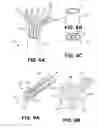 Fig. 08 - Expandable stimulation leads and methods of use