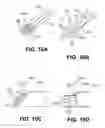 Fig. 09 - Expandable stimulation leads and methods of use