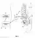 Fig. 02 - Medical device programming safety