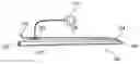 Fig. 01 - Bypass vascular graft