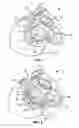Fig. 02 - Fixed anchor and pull mitral valve device and method