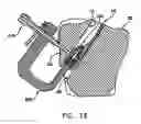 Fig. 09 - Apparatus and method for attaching a graft ligament to a bone