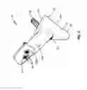 Fig. 06 - Sacral prosthesis and surgical method