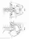 Fig. 07 - Sacral prosthesis and surgical method