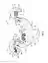 Fig. 08 - Sacral prosthesis and surgical method