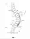 Fig. 02 - Energy-Storing Spinal Implants and Methods of Use