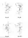 Fig. 09 - Energy-Storing Spinal Implants and Methods of Use