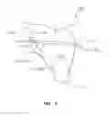 Fig. 06 - Glenoid component for shoulder arthroplasty