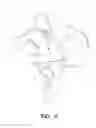 Fig. 07 - Glenoid component for shoulder arthroplasty