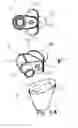 Fig. 05 - MODULAR SHOULDER PROSTHESIS WITH LOAD BEARING SURFACE