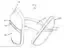 Fig. 01 - Ear Warmer Having A Membrane Forming A Receptacle
