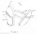 Fig. 02 - Ear Warmer Having A Membrane Forming A Receptacle