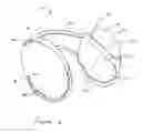 Fig. 06 - Ear Warmer Having A Membrane Forming A Receptacle