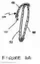 Fig. 07 - Ear Warmer Having A Membrane Forming A Receptacle